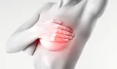 La menopauză, femeile cu diabet tip 2 sunt predispuse cancerului la sân?
