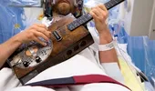 A cântat la chitară în timp ce se opera pe creier!