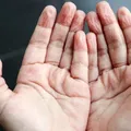 De ce pielea de pe degete se zbârcește în apă. Nu este doar pentru că pielea absoarbe apă