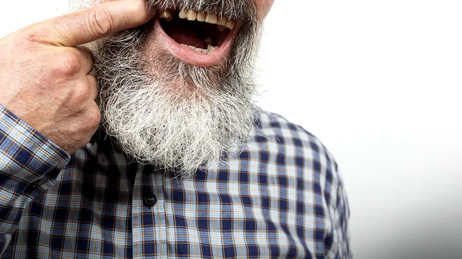 (P) Când pacientul își dorește o soluție rapidă pentru dinții lipsă, dar fără compromisuri