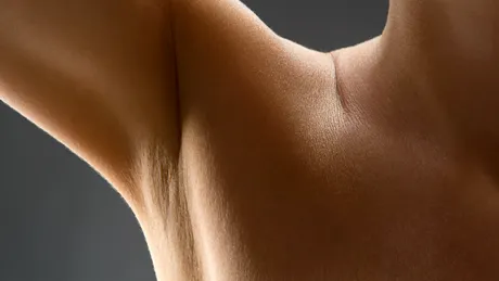 Pielea neagră la subraț poate fi primul semn de diabet. Ce alte boli pot fi de vină și remedii pentru albirea pielii de la subraț