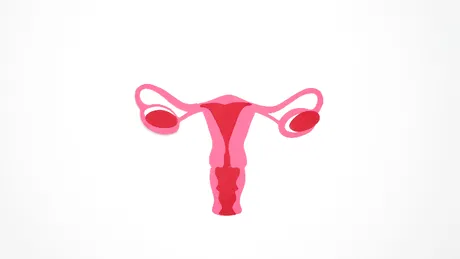 Chistul ovarian rupt: cum apare, simptome, diagnostic și tratament