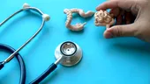 De ce tot mai mulți tineri se îmbolnăvesc de cancer de colon? Fenomenul a devenit îngrijorător la nivel global