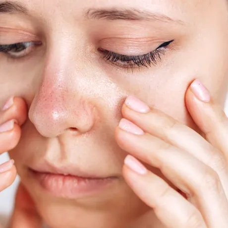 Cum să scapi de punctele negre de pe nas cu un prosop. Trucul care te ajută să ai o piele netedă