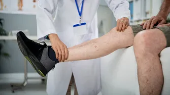 (P) Viața cu dureri de picioare: când devine o problemă reală?