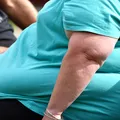 Diagnosticul de obezitate înainte de 30 de ani crește riscul de moarte prematură cu 70%
