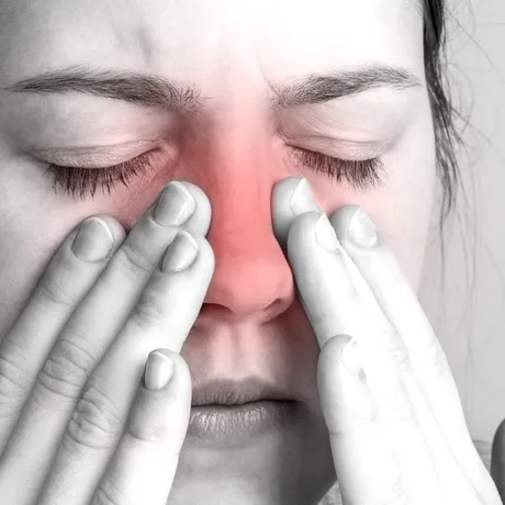 Dieta pentru sinuzită. Ce să mănânci pentru ameliorare rapidă și ce e de evitat