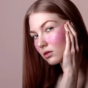 Rozaceea: cum se tratează corect și ce tehnologii moderne fac diferența