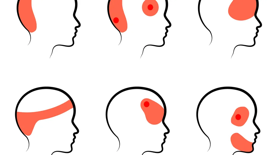 Ce înseamnă durerea de cap resimțită în tâmple, frunte sau în partea dreaptă și pastile pe care trebuie să le iei