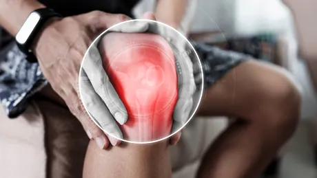 Simți că-ți fuge genunchiul? Ai putea suferi de sindromul de plică sinovială - care sunt cauzele și opțiunile de tratament