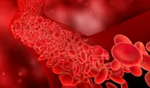 Ai eritrocitele scăzute? 5 metode prin care reglezi nivelul celulelor roșii din sânge
