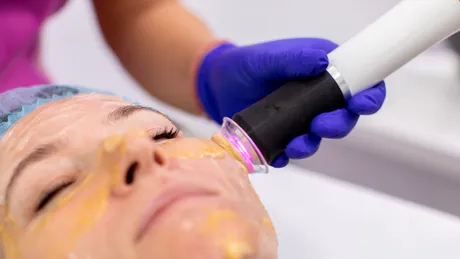 Rejuvenare facială în două etape: cum funcționează un protocol pentru revitalizarea tenului