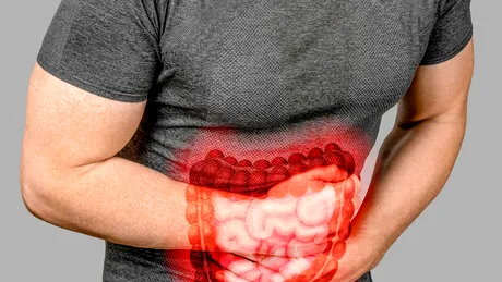 Ce poate ascunde o durere acută de abdomen?