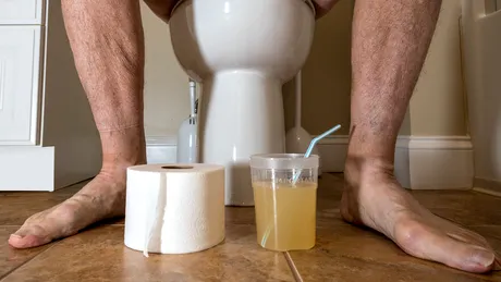 Pregătirea pentru colonoscopie: GHID pentru o procedură reușită și golirea completă a colonului