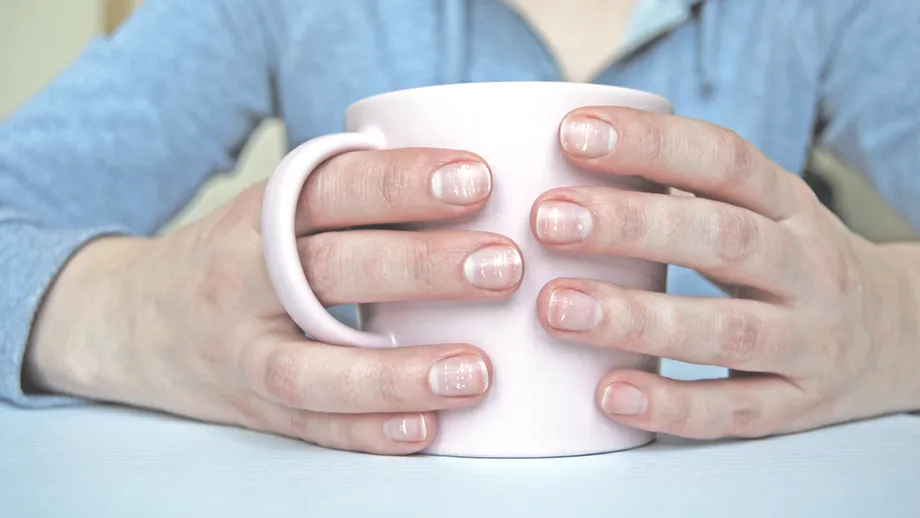 Liniile albe de pe unghii, semn de boli cardiovasculare, probleme cu ficatul sau rinichii. La ce să fii atent