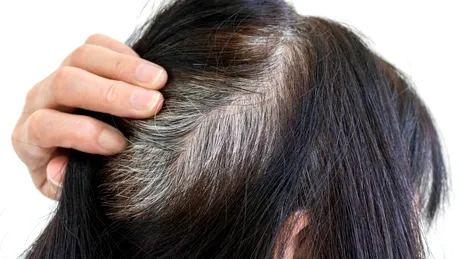 Ce să mănânci ca să întârzii albirea părului