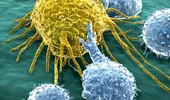 Chimioterapia potenţată de insulină, o speranţă pentru pacienţii cu cancer