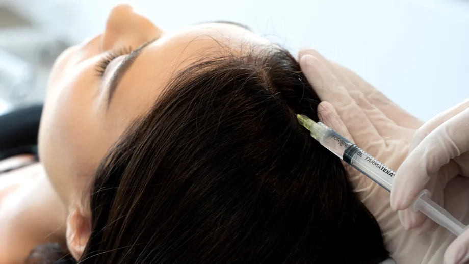 Alopecia: cum o combatem cu succes cu tratamente profesioniste