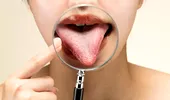 „Respirația mea mirosea a dizolvant de unghii”. Semnul aparent banal care ascundea o boală mortală
