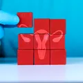 Fumatul poate agrava simptomele PMOS. Medicii explică de ce renunțarea la țigări este un pas important în controlul afecțiunii
