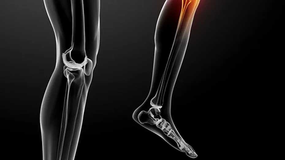 Conf. Dr. Daniel Grigorie: “Osteoporoza este boala oaselor care poate fi ţinută sub control!”