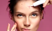 Dr. Viviana Iordache: sfaturi pentru îngrijirea tenului cu acnee pe timpul verii VIDEO