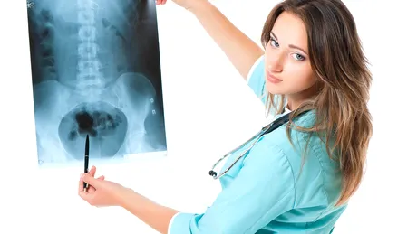 Cancer pulmonar: ce rol are imunoterapia