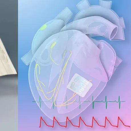 Plasturele revoluționar din grafen care se lipește pe inimă și corectează aritmiile cardiace
