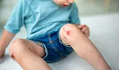 Planta care vindecă rănile. Are proprietăți uimitoare și este folosită din vechime în medicina naturistă