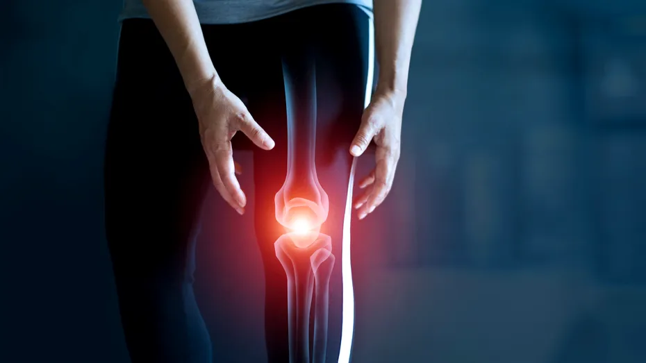 Gonartroza genunchiului de la A la Z | Dr. Mihai Râșcu: “Oricine poate deveni protagonistul acestei povești odată cu înaintarea în vârstă”