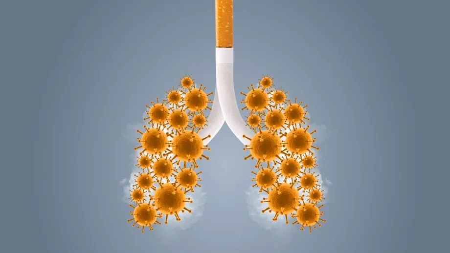 Pneumolog: Fumătorii cu BPOC riscă să dezvolte forme grave de COVID-19