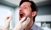 Nu au fumat niciodată, dar au făcut cancer oral. Semnalele de alarmă pe care tinerii le ignoră
