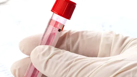 Premieră în medicină: Un britanic ar putea fi prima persoană tratată de virusul HIV
