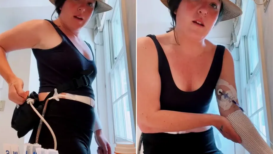 Tânără de 30 de ani, conectată la priză ca să aibă puls. „Când ies din casă îmi pun baterii”