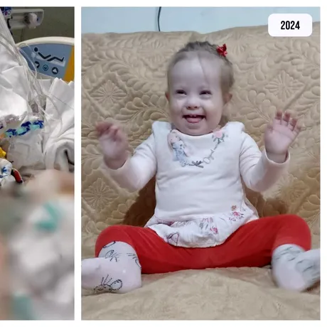 Măriuța avea două găuri în inimă. La un an de la operație, copila din Bucovina este „perfectă”