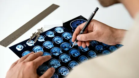 Scleroza multiplă: 8 semne la care să fii atent. Unul dintre ele se observă la toaletă