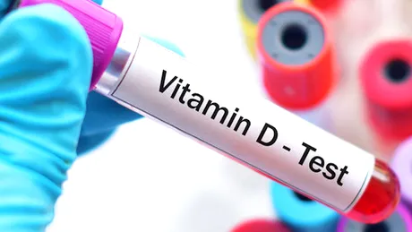 Dr. Antoanela Curici: testele pentru vitamina D şi valorile optime în organism INTERVIU