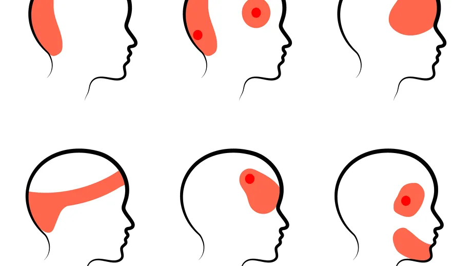 Ce înseamnă durerea de cap resimțită în tâmple, frunte sau în partea dreaptă și pastile pe care trebuie să le iei