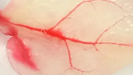 O frunză de spanac, transformată în ţesut cardiac uman VIDEO