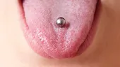 Piercingul în limbă, un pericol pentru sănătatea orală. Cum ne îmbolnăveşte