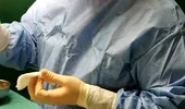 Dr. Ştefan Tucă, chirurg: varicele pot fi letale