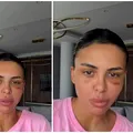 Andreea Popescu, dezvăluiri despre ultimele operații suferite: „Mi-a căzut părul enorm”. Ce intervenții estetice și-a făcut vedeta