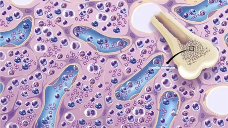 Legătura neaşteptată dintre leucemie şi vitamina B6