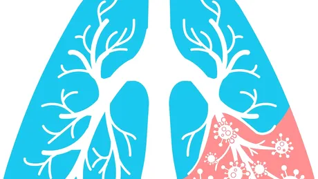 A fost depistat un nou tip de pneumonie. Primele persoane au fost deja infectate