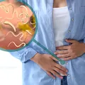 Paraziții intestinali: 7 remedii naturale eficiente pentru eliminarea lor