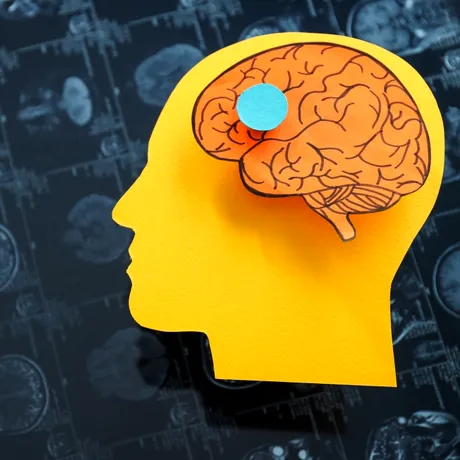 Un aliment surprinzător ar putea proteja creierul. Acesta este asociat cu un risc mai mic de demență