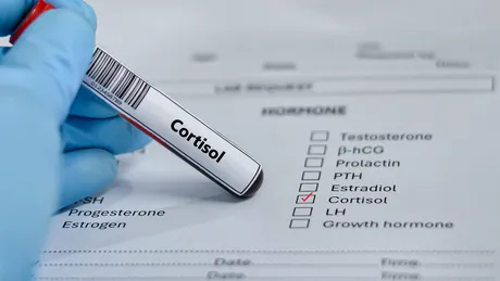 14 semne care apar când cortizolul scapă de sub control