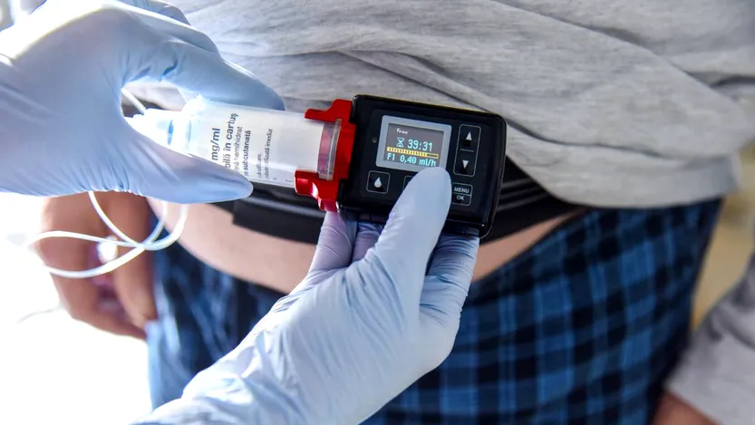 Cum funcționează tratamentele pentru boala Parkinson asistate de dispozitive