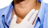 Noduli tiroidieni maligni – analizele care arată dacă sunt cancerigeni