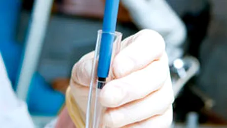 Un test de depistare a hepatitei C, rapid şi ieftin, creat de cercetătorii egipteni